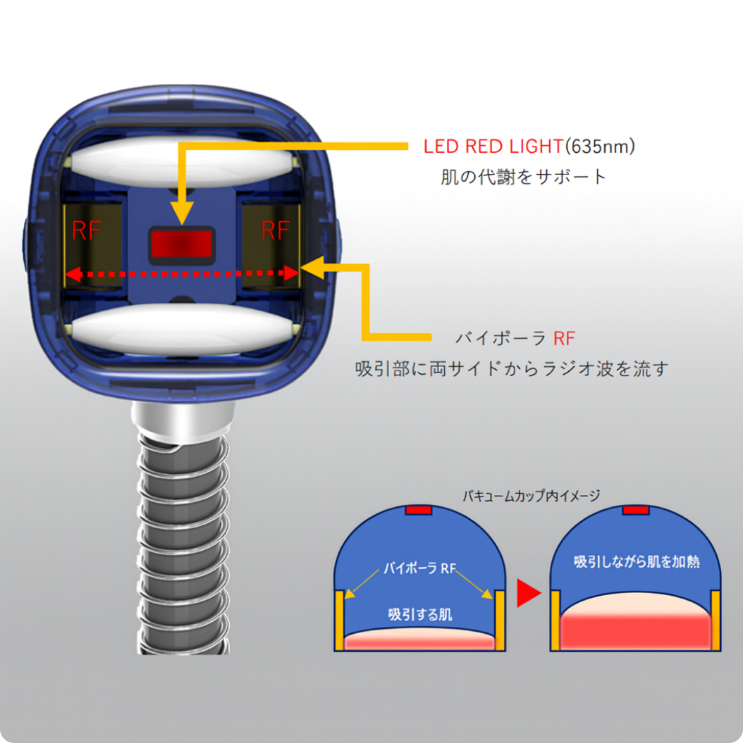 RFバキューム構造図