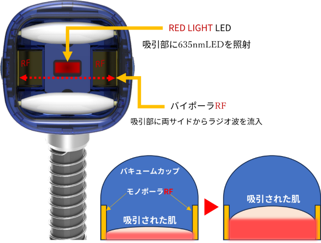 バキューム